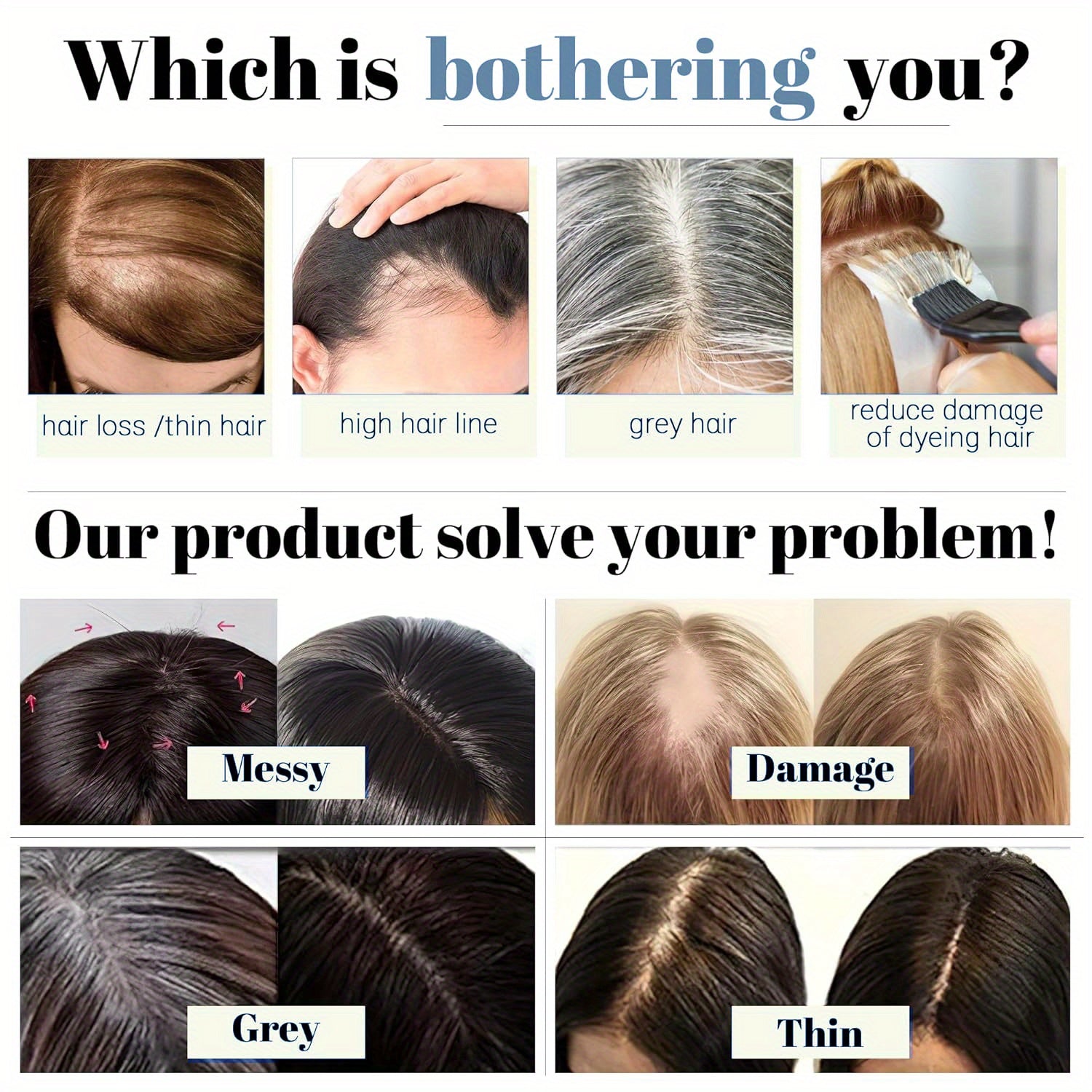 8/10 Inch Invisible Human Hair Base Toppers, 100% Human Hair Topper with Bangs, Lightweight Hair Pieces for Women with Thinning Hair, #30 Color Women'S Clip-On Hair Replacement, Straight Hair Invisible Topper 3D Hair Toppe